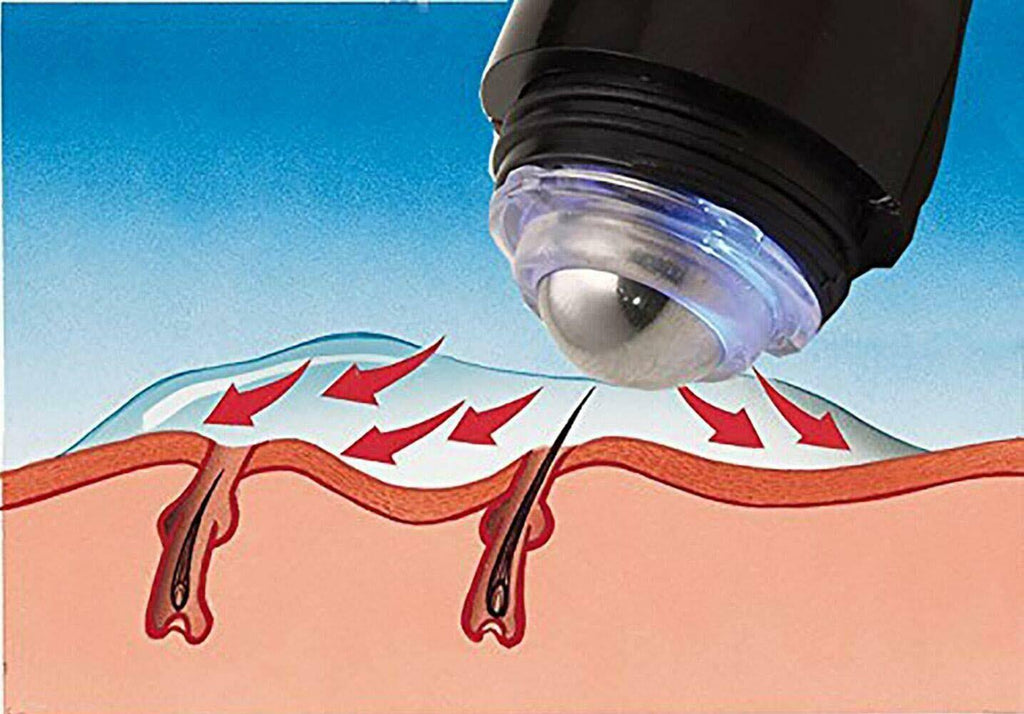 Verseo eSmooth Permanent Hair Removal System R40893